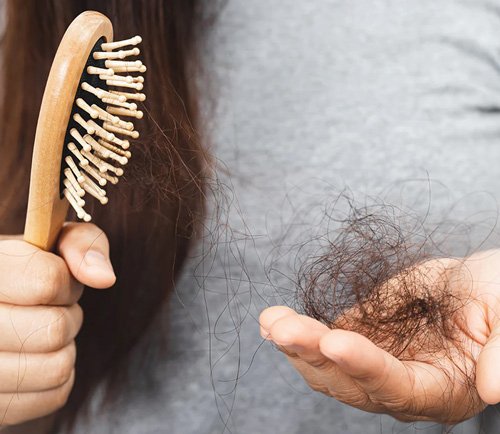 جلوگیری از ریزش مو با مکمل زینک